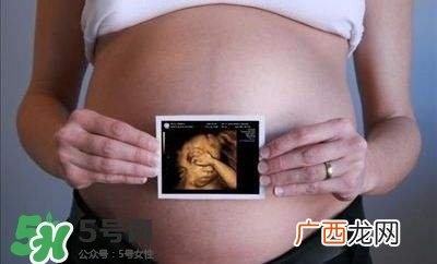 四维彩超能看出男女吗？四维彩超能看清手指吗？