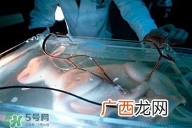 人造子宫能生孩子吗？人造子宫成功案例