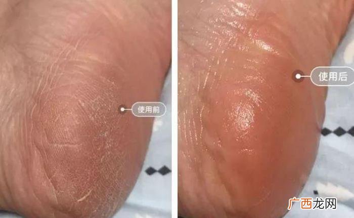 佟丽娅搓脚，佟丽娅徒手帮其&amp;quot;搓脚&amp;quot;