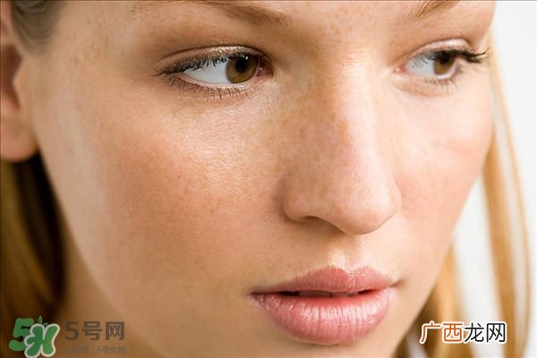 孕斑能用什么方法去除 孕斑怎么去