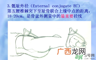 盆骨多大适合顺产 盆骨多大可以顺产