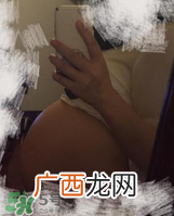预防妊娠纹用什么好？怀孕期间如何预防妊娠纹