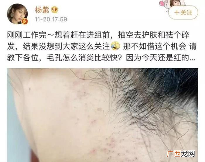 杨紫整容了吗，杨紫真的没有对自己的面部进行过整容