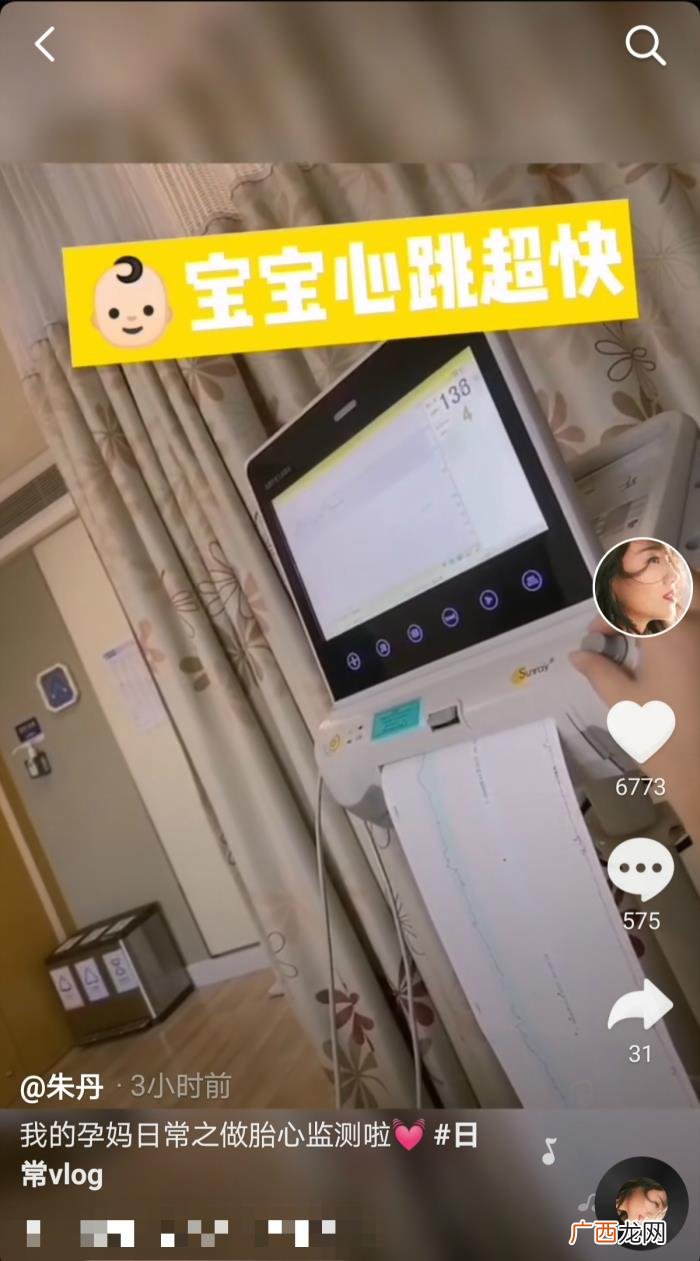 39岁朱丹高龄产子 朱丹个人资料简介