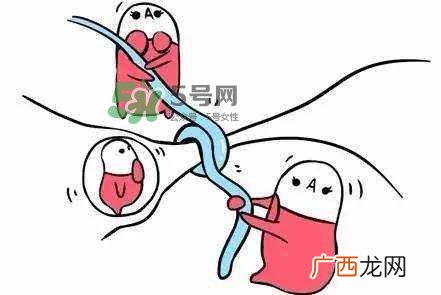 结扎好还是上环好？结扎上环哪个危害小？