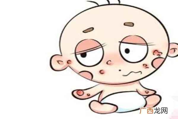 过敏宝宝怎么添加辅食 这几点妈妈们一定要注意