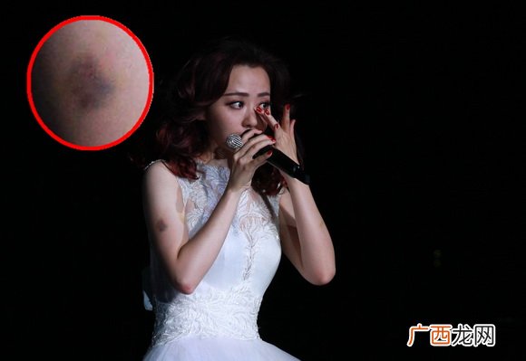 张靓颖老公是谁，张靓颖为什么逼婚