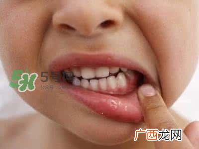 怎么防止宝宝长蛀牙？别让孩子吃大人的口水