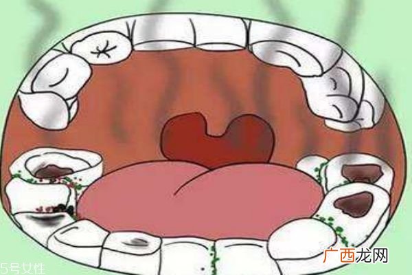 宝宝嘴巴里有臭鸡蛋味怎么办 口臭问题不能忽视