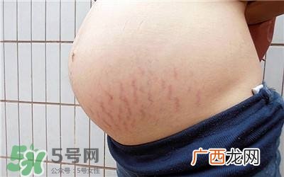 妊娠纹几个月开始出现？妊娠纹能消除掉吗？