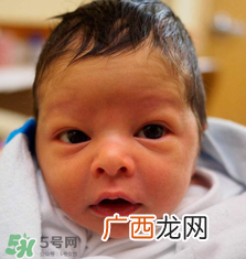 早产儿的智力会有影响吗？早产儿智力低下吗？