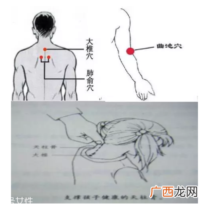 吮痧有什么疗效？最温柔的治病方法