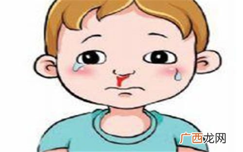 儿童流鼻血有何危害？治疗要及时