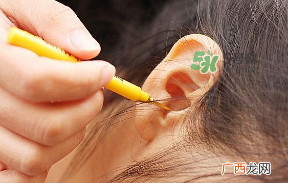 儿童耳屎成硬块怎么办？儿童耳屎成硬块有危害吗？