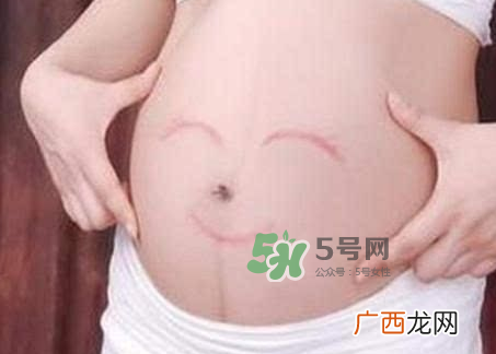 产妇胃胀气怎么缓解？产妇胃胀气怎么办？