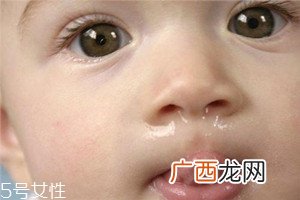 冬季宝宝流鼻涕是什么原因？教你几招轻松应对
