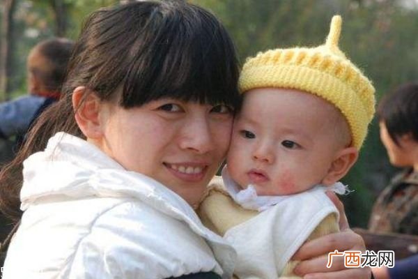 宝宝奶藓会自己好吗 宝宝奶藓怎么办