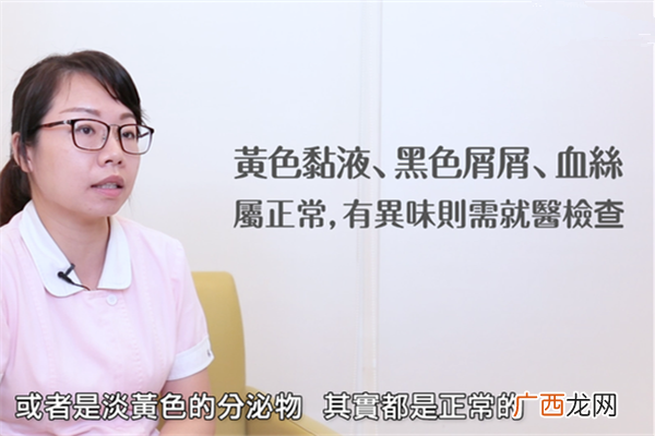 新生儿肚脐怎样护理 护理四妙招