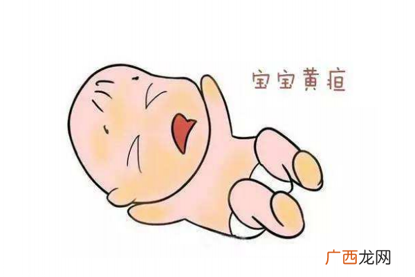 母乳性黄疸怎么办 多久能退完