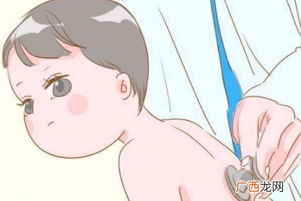 宝宝怕热出汗怎么回事 宝宝怕热的表现
