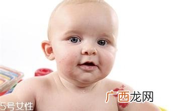 宝宝胎记会自动消失吗？不同胎记消失情况不同