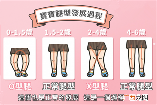 宝宝腿型变化图解 宝宝腿型发展过程图