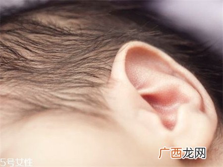 新生儿耳朵上有黑毛怎么回事 注意两种情况