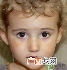 热性惊厥的临床表现 如何判断宝宝是不是热性惊厥？