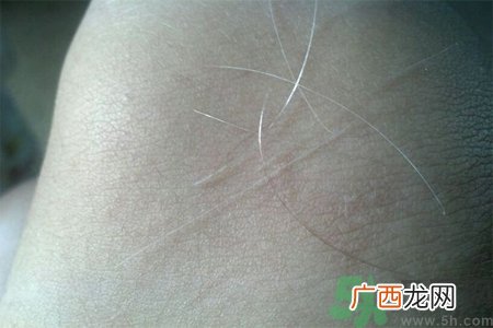 生完宝宝白头发的原因？生完宝宝白头发怎么办？