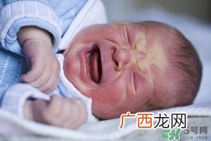 病理性黄疸孩子有何症状 病理性黄疸的特点