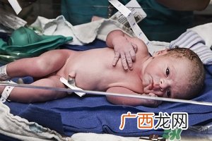 病理性黄疸孩子有何症状 病理性黄疸的特点