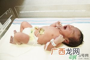 病理性黄疸孩子有何症状 病理性黄疸的特点