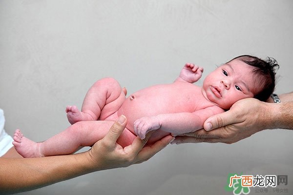 新生儿黄疸高怎么办 婴儿黄疸高怎么办