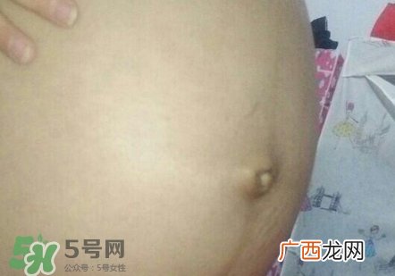 产后肚脐眼臭是怎么回事?产后肚脐眼臭怎么办?