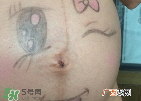 产后肚脐眼臭是怎么回事?产后肚脐眼臭怎么办?