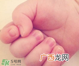 宝宝指甲凹凸不平是什么原因?宝宝指甲凹凸不平正常吗?