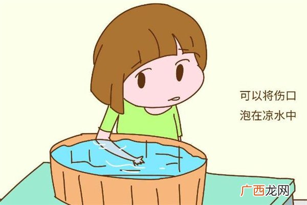 为什么手烫伤要摸耳朵 手被烫伤摸耳朵有用吗