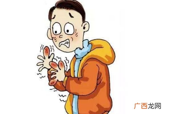 手上的冻疮怎么止痒 可以用泡盐水止痒