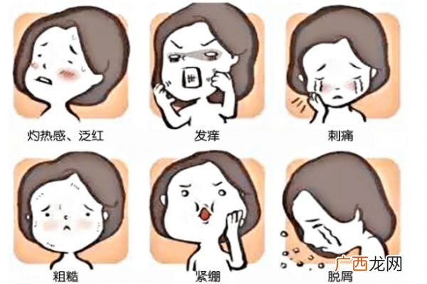 激素脸和过敏脸区别 治疗激素脸要摆正心态