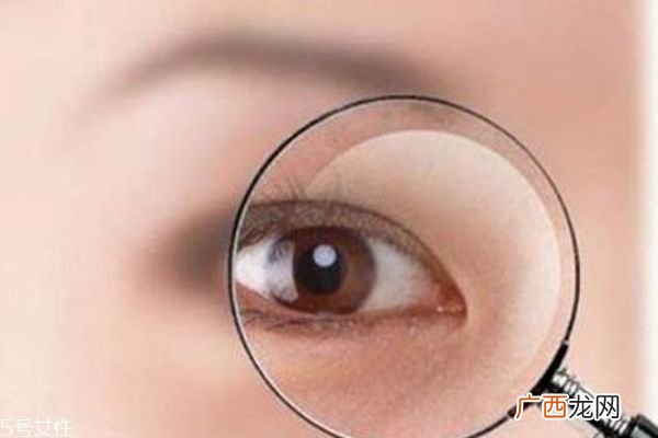 迎风流眼泪是为什么 告别风沙眼