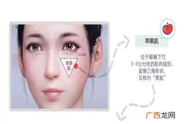 苹果肌和颧骨高区别 别再傻傻分不清楚