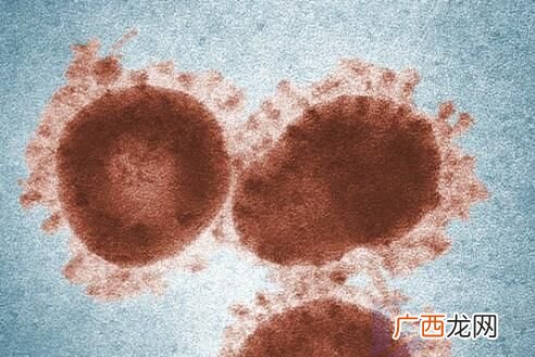 新冠病毒或直接对心脏DNA产生影响 不仅仅是引发炎症