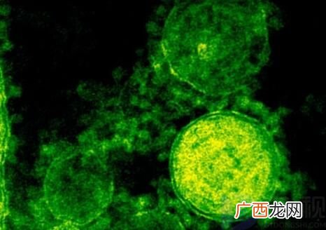 新冠病毒或直接对心脏DNA产生影响 不仅仅是引发炎症