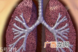 肺大泡怎么治疗 最好选择手术