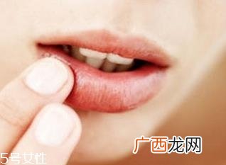 嘴唇上长泡不疼怎么办 7种方法教你解决