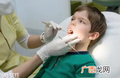牙结石能自动脱落吗？除了洗牙别无他法