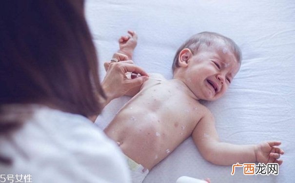 水痘有何传播途径？多发于春秋季