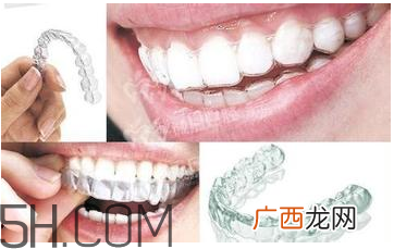 牙套的作用 牙套要戴多久
