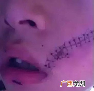 冰箱拿饮料爆炸 什么饮料不能放冰箱