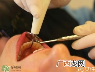 拔牙疼吗 拔牙疼不疼